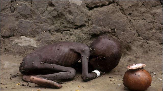 非洲饥饿儿童难民图片